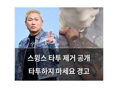 스윙스 타투 제거 공개 타투하지 마세요 경고