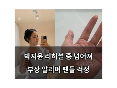 박지윤 리허설 중 넘어져 부상 알리며 팬들 걱정